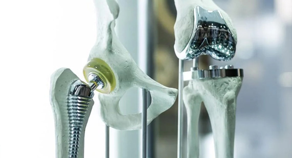 Medical Industry Applications of Titanium Alloys